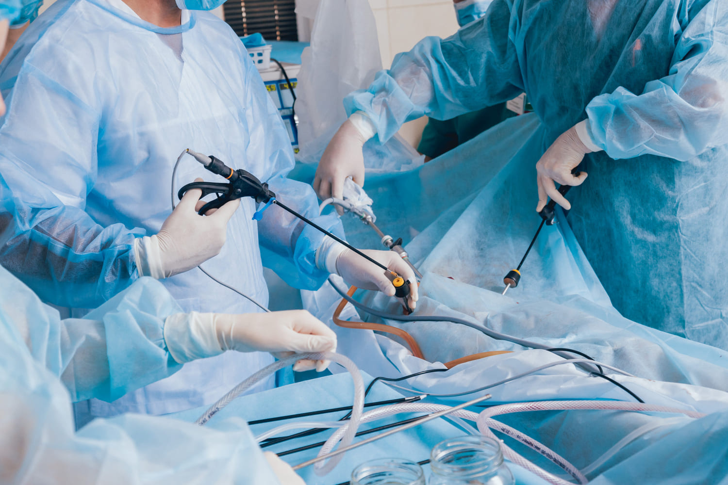 Cirugías realizadas por laparoscopia (mínima invasión) o manejo abierto de acuerdo a cada paciente en Naucalpan: Atención Personalizada en Cirugía General