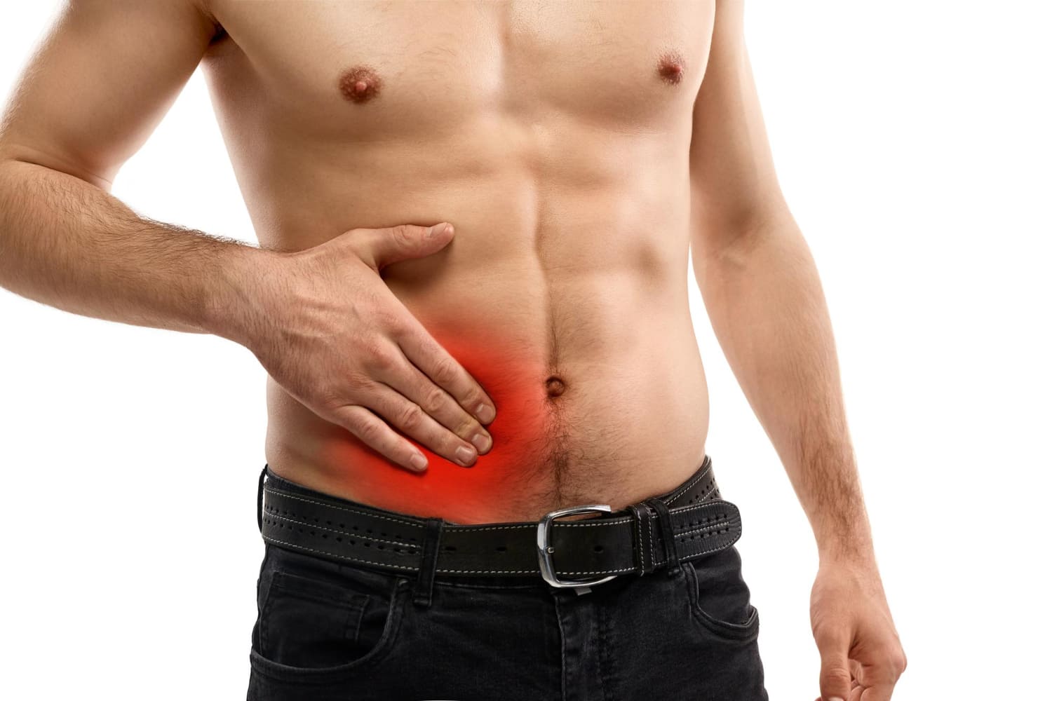 Especialistas en Hernia de pared abdominal en Naucalpan: Cirugía General Avanzada