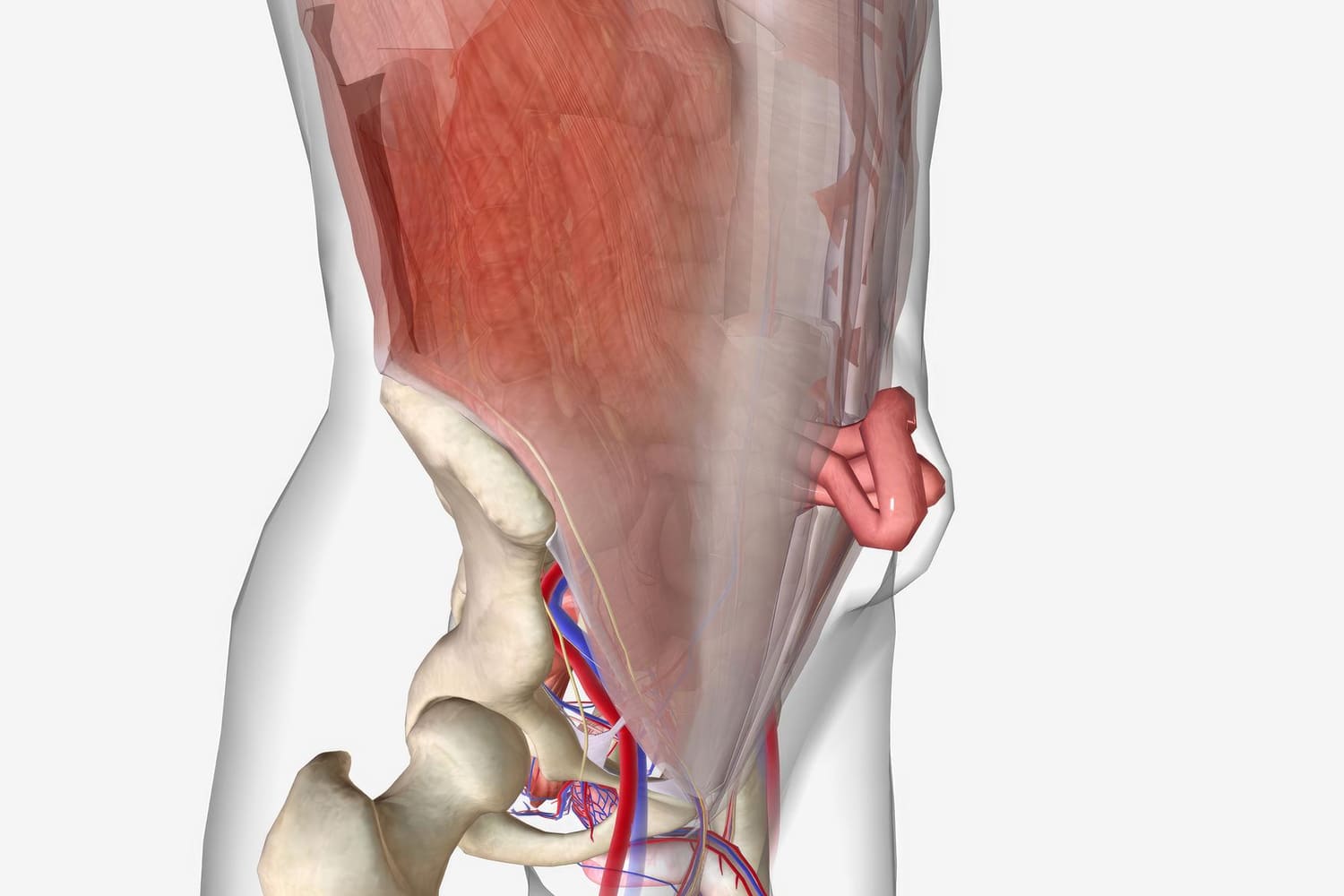 Cirugía Especializada para Hernia Umbilical en Naucalpan: Tratamiento Seguro y Efectivo